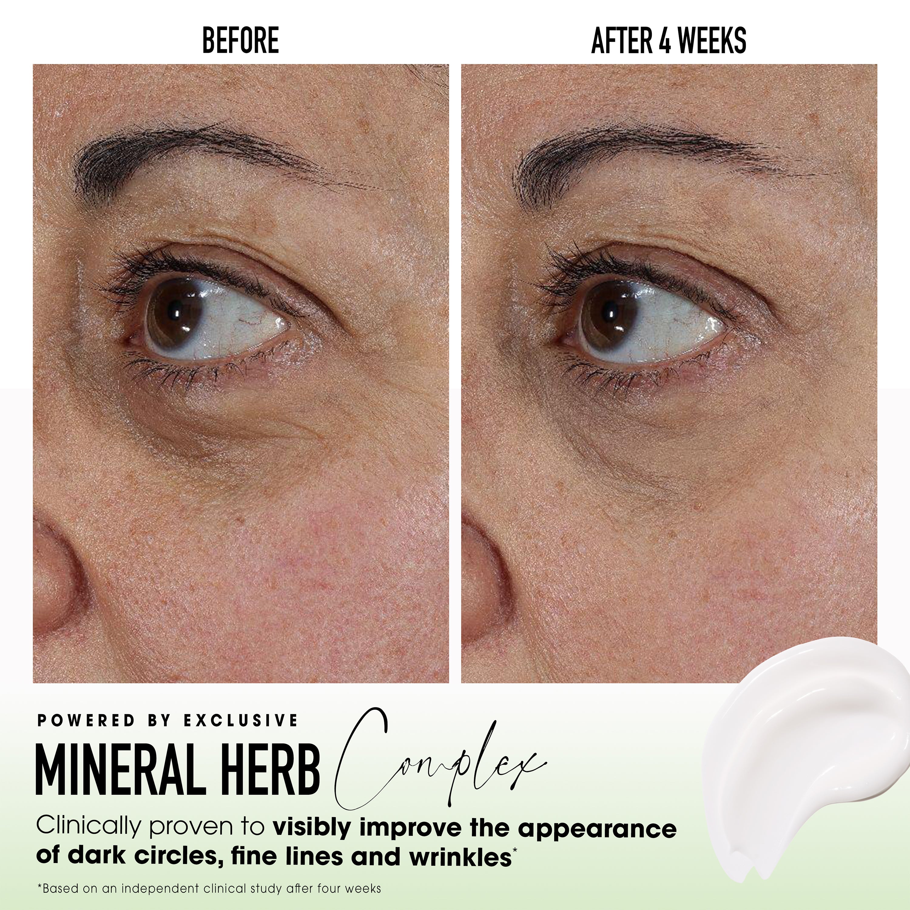 SKINLONGEVITY® Under-Eye Essentials Duo