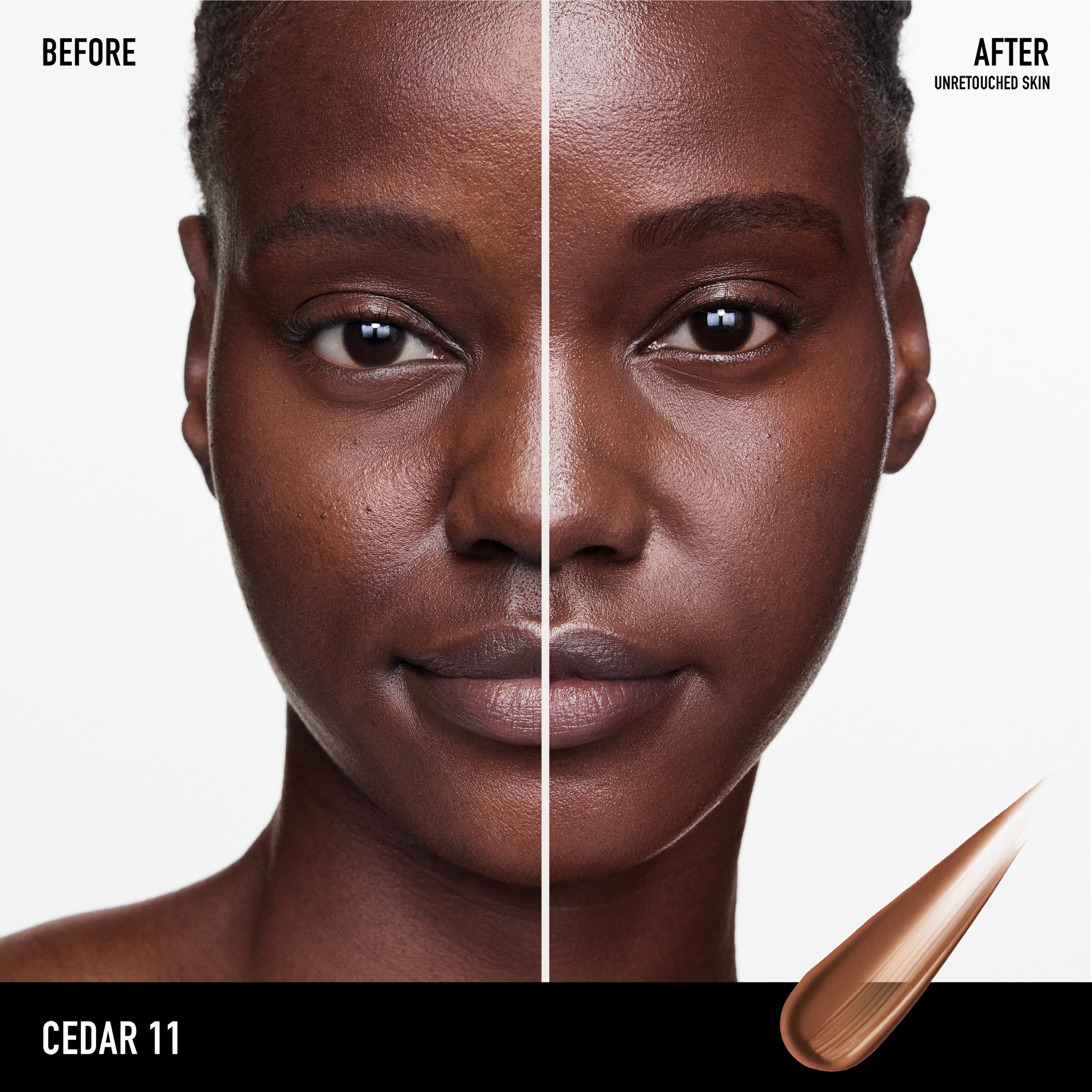 Cedar 11